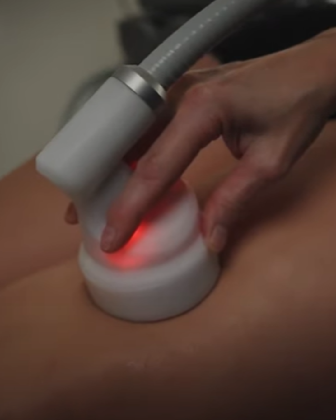 Cryotherapy